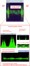 Figure 16 - Example of an oriented analysis leading to the identification of an "intruder" signal NMT 900 (Nordic Mobile Telephone 900 MHz)