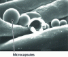 Figure 8 - Electron microscope image of microcapsules