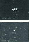 Figure 13 - Polymeric wear particles from an inflammatory pannus (from [29])