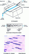 Figure 9 - Ferrograph, principle of the analytical ferrogram and example of a ferrogram of ferrous particles (after [24] [25]).