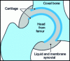 Figure 2 - Diagram of a natural hip joint