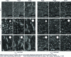 Figure 49 - SEM images of stainless steel surface obtained at two fluence values (after [35])