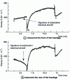 Figure 13 - Field variations induced on the fuselage by the approach of a lightning channel (measurements on C160 aircraft)