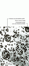 Figure 1 - Transmission electron microscope view of ABS