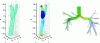 Figure 15 - Blood flow simulation