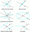 Figure 14 - The different types of affine conics