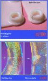 Figure 9 - Welding line on an injected part (http://plastics.dupont.com)