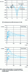 Figure 10 - Profile of the residual groove and nanohardness of the edge of the groove formed by a Berkovich pyramid radiating edge-first or face-first into the PMMA with penetration 