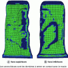 Figure 42 - Numerical simulation of blowing during the plating phase