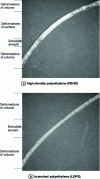 Figure 3 - Plug or oscillating fault