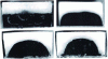 Figure 7 - Example of coating during the flow of two polymers in a rectangular channel (after [1])