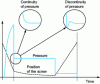 Figure 6 - Continuity and discontinuity of pressure in front of the screw during switching