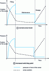 Figure 7 - Influence of screw position reduction during the filling phase