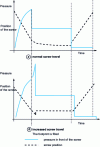 Figure 8 - Influence of increasing screw stroke during filling phase