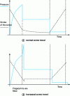 Figure 12 - Increased screw travel