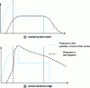 Figure 13 - Screw travel too high