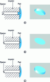 Figure 44 - Realization of the part interface – ejector