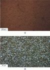 Figure 6 - Micrograph of X130WMoCrV 6-5-3-8 steel – 4% Nital etchant