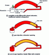 Figure 2 - Feeder filling technique