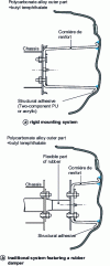 Figure 14 - Structural bonding of shields and bumpers (source: Adhesives and sealants ASM International)