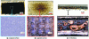 Figure 14 - Macro- and microscopic observations
of a carbon/glass/PEEK laminate subjected to a kerosene flame for
15 minutes (after [26])