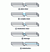 Figure 21 - Compression tests: failure modes, in accordance with EN ISO 14126