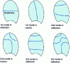 Figure 54 - Examples of vibration modes of propeller blades ( = 1.30 m) in air [2]