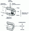 Figure 11 - Influence of radial clearance in a keyed assembly