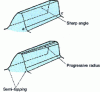 Figure 18 - Pinion-tooth with or without racking and semi-topping
