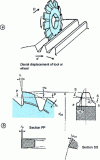 Figure 3 - Cutter-discs: characteristics