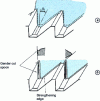 Figure 7 - Possible arrangements for rack and pinion tooth edges