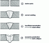 Figure 4 - Welding defects