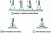 Figure 6 - Different types of metal transfer