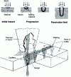 Figure 1 - Capillary formation