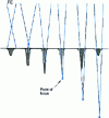 Figure 9 - The effect of focusing on the appearance of the fused zone