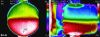 Figure 22 - IR camera views of the exchanger front box, left front and right side (NeoTherm Consulting SAS)