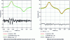 Figure 25 - Temperature profiles on heated outer surface