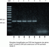 Figure 8 - Agarose gel electrophoresis