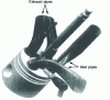 Figure 17 - BMW 320 d intake and exhaust pipes