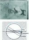 Figure 7 - Cavitation erosion of a shaft line bearing due to flow in the crankshaft journal bore (photo Glacier Metal; [6])