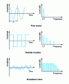 Figure 13 - Example of signals represented in frequency bands
