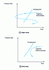 Figure 35 - Dynamic compression loop simulations