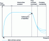 Figure 11 - Influence of the critical discharge pressure in a mechanical primary pump-diffusion pump combination