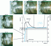 Figure 9 - Evolution of performance, cavitation figures and airborne noise as the available NPSH falls