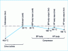 Figure 23 - Vertical guidance: cold edging of axes on each machine