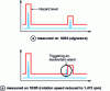 Figure 9 - Untimely alarm triggering on an RC spectrum