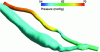 Figure 23 - Example of IFS simulation for a blood vessel (source: Decorato et al. [18])