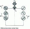 Figure 4 - Six-row ball contact angle