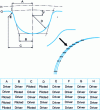 Figure 11 - Parametric gear design (automotive application)