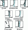 Figure 3 - Different chip morphologies depending on the material being machined